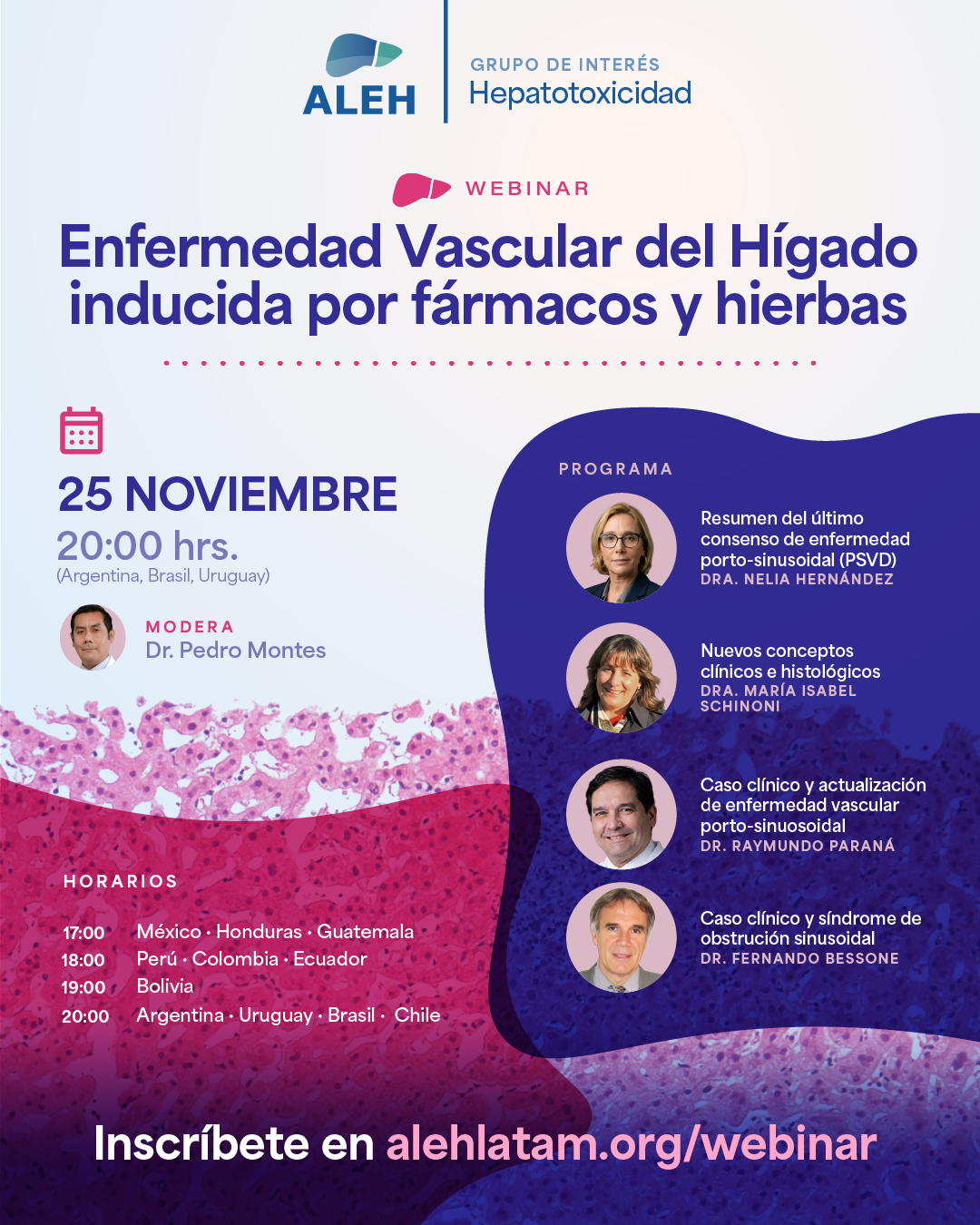 Afiche del Webinar: "Enfermedad Vascular del Hígado inducida por fármacos y hierbas" organizado por el Grupo de Intéres de Hepatotoxicidad de ALEH.